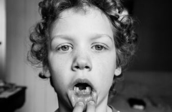 Revolutionizing Dental Care: Tooth-Rising Drug Trials To Begin In July 2024